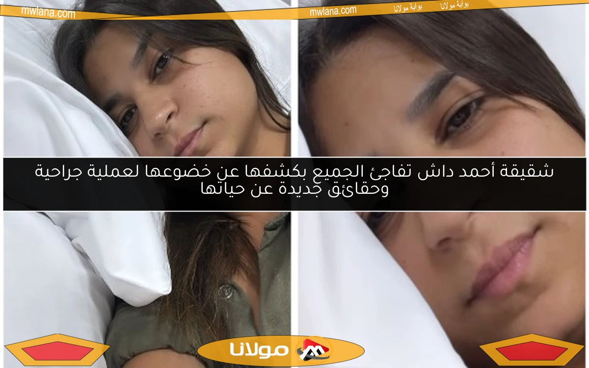 شقيقة أحمد داش تفاجئ الجميع بكشفها عن خضوعها لعملية جراحية وحقائق جديدة عن حياتها