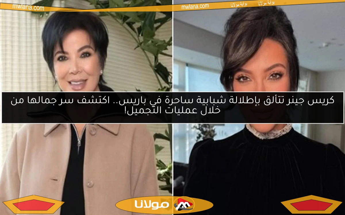 كريس جينر تتألق بإطلالة شبابية ساحرة في باريس.. اكتشف سر جمالها من خلال عمليات التجميل!