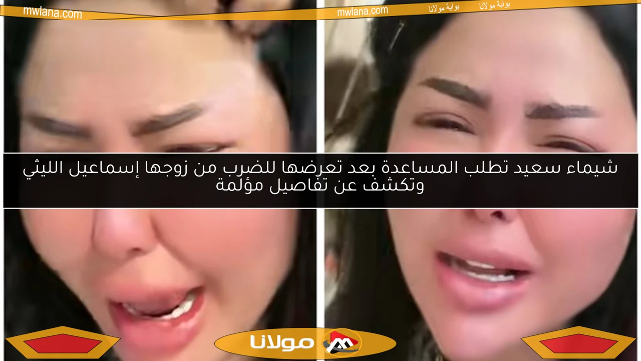 شيماء سعيد تطلب المساعدة بعد تعرضها للضرب من زوجها إسماعيل الليثي وتكشف عن تفاصيل مؤلمة